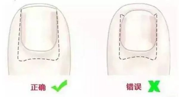 为甚么剪指甲不会疼,剪指甲不疼是怎样回事
